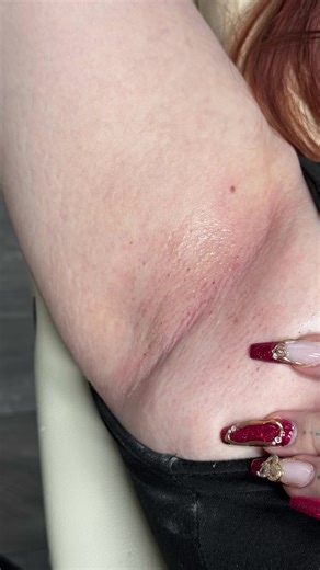 How to Do Sugar Waxing at Home: A Step-by-Step Guide