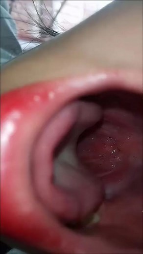 Exploring the Unique Features of the Human Tongue