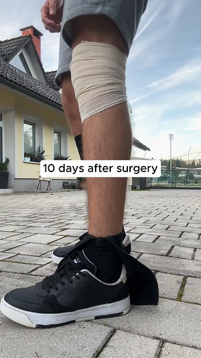 Put on compression socks pain-free in seconds Get yours here: https://gripstander.com/products/zippra™-medical-compression-socks | Zippra