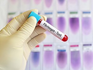Fibrinogen Activity Test / أختبار الفيبرونوجين