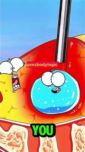 Pimple's Worst Nghtmare! #pimplepopping #shorts