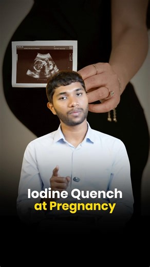 Check your iodine levels | Dt Siva Prasath