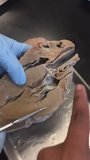 moderator band, tribeculae cardinae, left ventricle, left atrium, right atrium, right ventricle