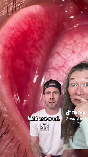 Parasites in the Eyes: Understanding Eye Health Risks