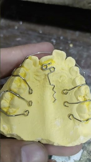 Z-spring orthodontic Appliance Making By the #z-spring#orthodontic #appliances #dentalartbyhaider