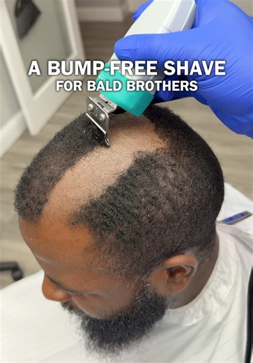 Mastering the Art of Shaving for Smooth Skin