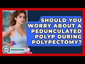 Should You Worry About A Pedunculated Polyp During Polypectomy? - Colon Health Channel