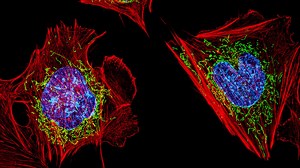 Solving the Mystery of Nuclear Speckles | Cell And Molecular Biology