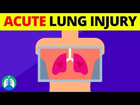 Acute Lung Injury (ALI) | Medical Definition
