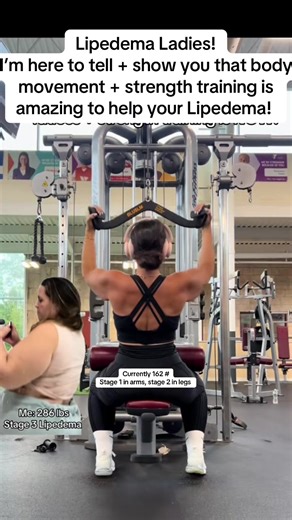 Lipedema Management: Benefits of Nutrition and Fitness