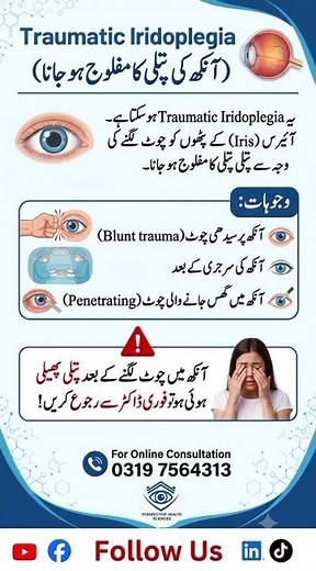 Traumatic Iridoplegia | Paralysis of the Pupil | Eyehealth