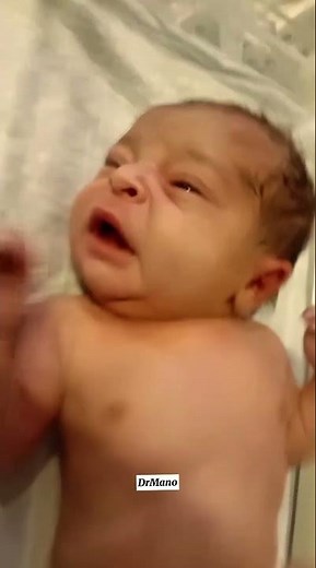 Cute Baby Angry Sound & Tiny Sneeze 🤧💛 #CuteBaby #NICU