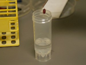 Murine Heterotopic Heart Transplant Technique