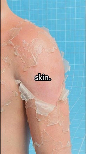 The Sun Doesn’t Burn Your Skin😱