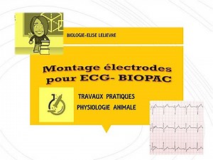 TP ECG : Montage des dérivations avec le logiciel BIOPAC