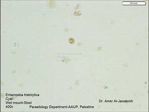 Entamoeba histolytica-Cyst