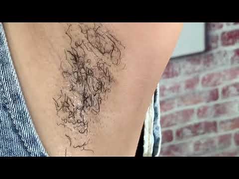 My Armpit Hair Removal Review in EASY WAY