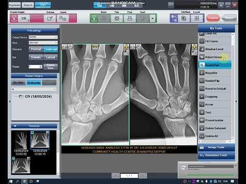 Konica Minolta Imagepilot Software Demo / ImagePilot OPERATING VIDEOS