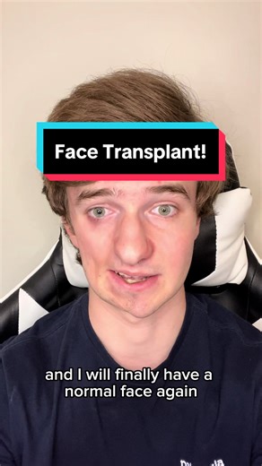 Face Transplant Surgery Process Explained