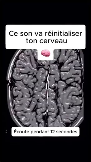 Ma Routine Articulaire on Instagram: "🧠 Le son qui réinitialise ton cerveau en 12 secondes 🔁🎧 🔥 Abonne-toi à notre page @ma_routine_articulaire pour recevoir une routine articulaire gratuite en DM ! Tu te sens mentalement saturé, dispersé, ou constamment fatigué même après une pause ? Ce post te partage un outil ultra simple et pourtant puissant : ➡️ Un son de réinitialisation cérébrale à écouter pendant 12 secondes seulement. Mais comment un simple son peut-il agir sur ton cerveau ? 🎶 Il u