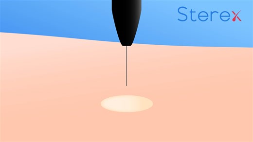 MILIA ANIMATION - Small Explode