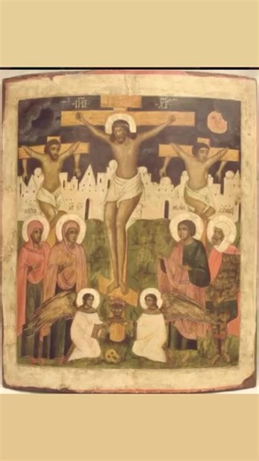 3.9K views · 744 reactions | Eikon U Procope on Reels | Facebook