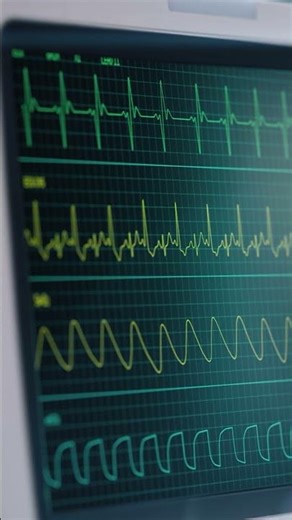 ECG Test Explained! What Your Electrocardiogram REALLY Shows About Your Heart #shorts