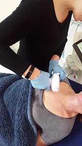 Lumecca: IPL Treatment for Sun Spots