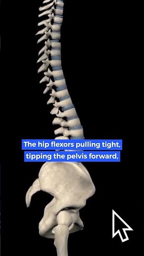 What causes Lumbar Spine curvature?