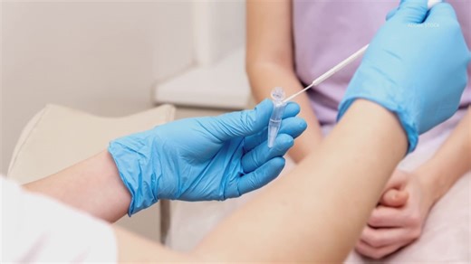 At-home HPV test now accepted in American Cancer Society's latest guideline