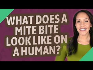 What does a mite bite look like on a human?