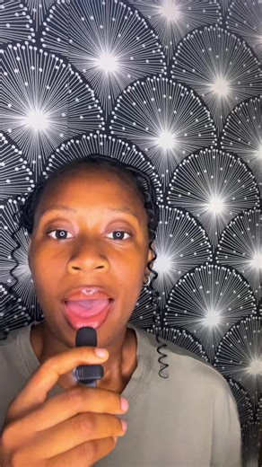 Debunking Myths About Epilepsy