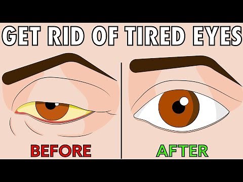How to naturally get rid of tired eyes in 2 easy steps