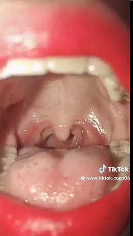 #Tongue #smoothlips #lipglossssssssss #oral #fypシ゚viralvideo #funtiktoks