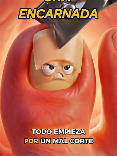 Prevención de Uña Encarnada: Cuida tus Pies