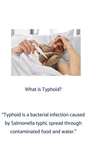 Typhoid fever management