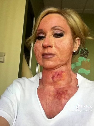 Amy Duncan Hawaii Episode Explained | Good Luck Charlie