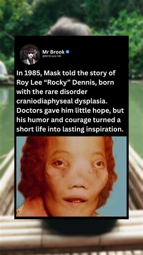 In 1985, Mask told the story of Roy Lee "Rocky" Dennis, born