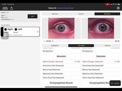 Reflex Pro: Alpha Omega pupil detection