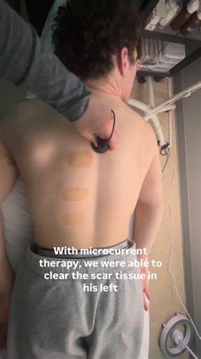 Hot Mess to Holistic | Microcurrent Westlake on Instagram: "College wrestling is tough on the body. Microcurrent therapy helped reduce inflammation, clear scar tissue, and support real recovery in the shoulder and back. #CollegeWrestling #AthleteRecovery #SportsInjury"