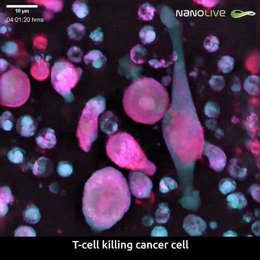 T Cells Killing cancer Cells