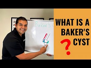 What Is A Baker’s Cyst? [Swelling Behind The Knee]