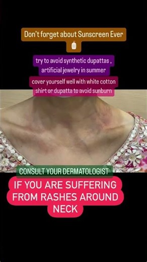 Suffering from Neck rash This Summers? Know from Dermatologist! Dr Ashima Goel MD #parisaskinclinic