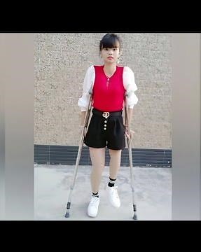 Beautiful woman walking with one leg on crutches #short_leg
