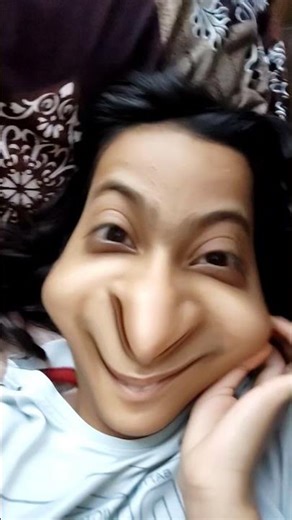 dheko my nose surgery hogai gys.|‪@editzwithASTHETICe8y6n‬