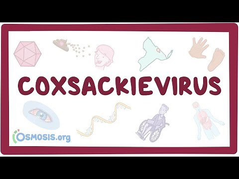 Coxsackievirus - an Osmosis Preview