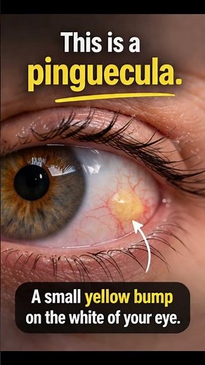 Are Your Eyes Turning Yellow? It’s Probably This