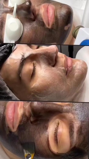 Advance technology in VLCC salon Phagwara bookings are open for carbon facial and hydra Facial... Call 9654790109,9463089234 | Vlcc phagwara