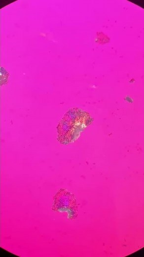 CASPA BAJO EL MICROSCOPIO 🔬