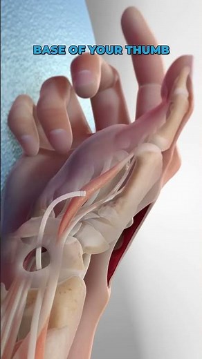 Basal Joint Surgery 3D Animation | #shorts #surgeryeducation